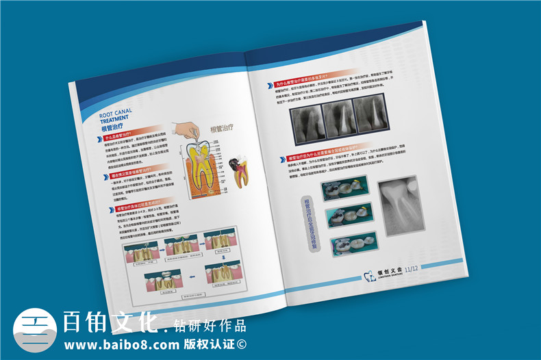 義齒產(chǎn)品宣傳手冊-義齒廠家圖冊假牙制造口腔修復(fù)公司畫冊設(shè)計